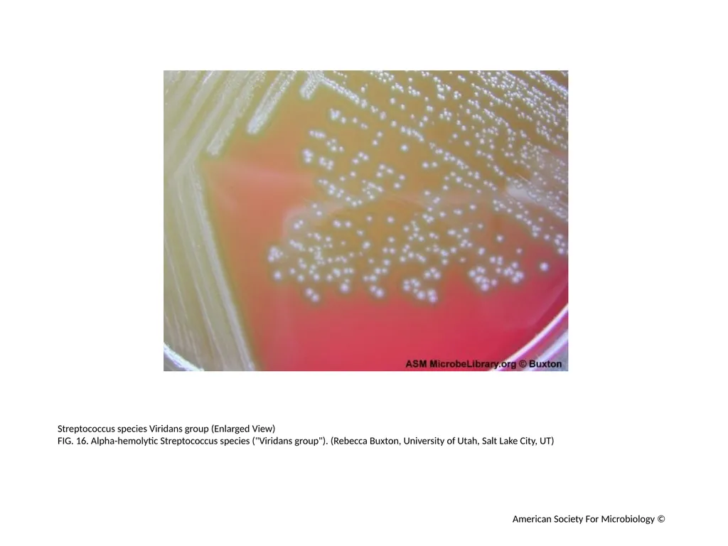 Blood Agar Plates and Hemolysis: Streptococcus - slide 17 of 44