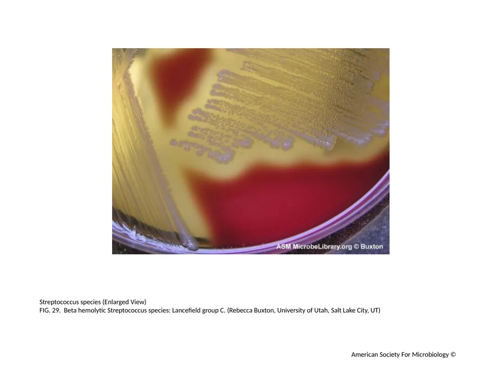 Blood Agar Plates and Hemolysis: Streptococcus - slide 30 of 44