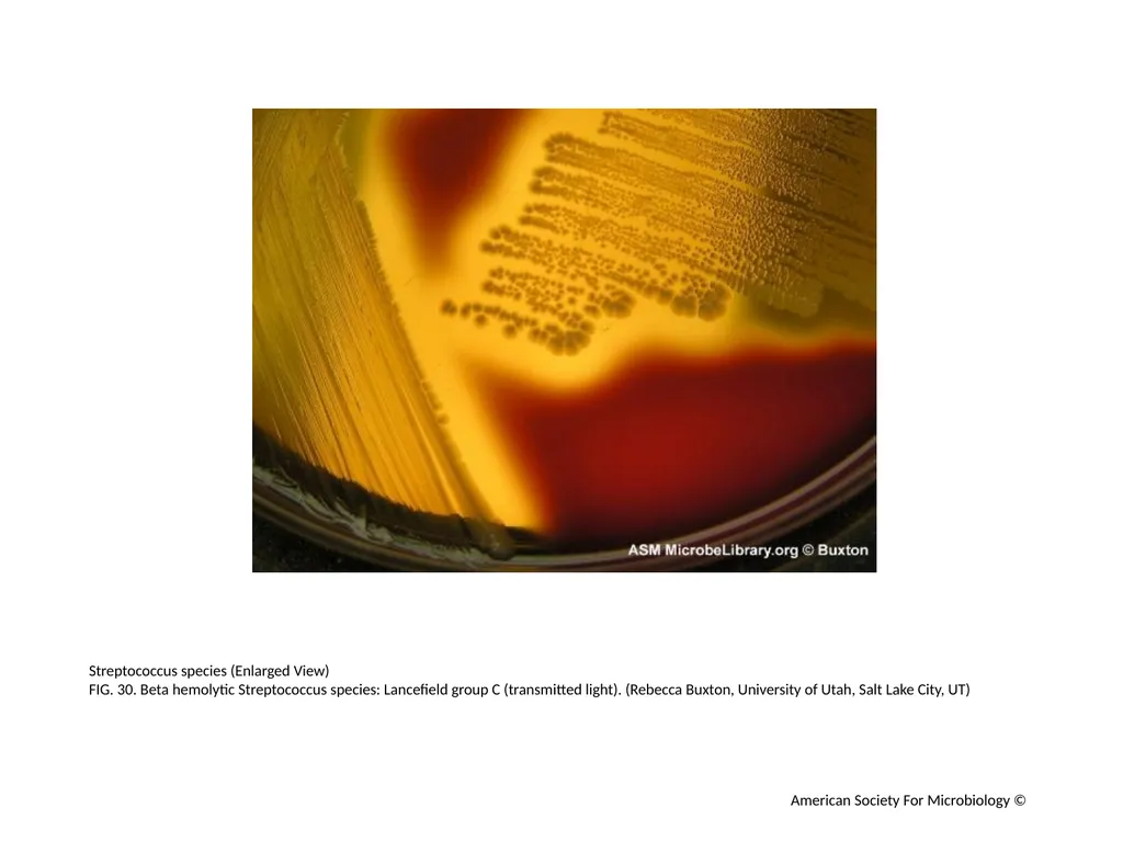 Blood Agar Plates and Hemolysis: Streptococcus - slide 31 of 44