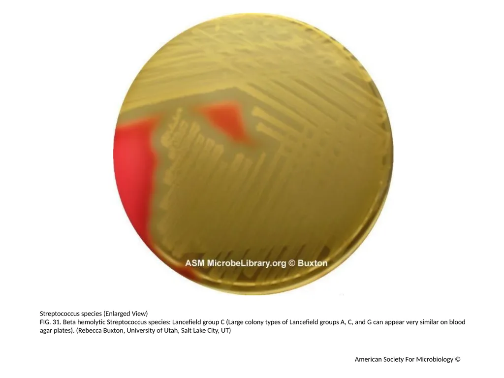 Blood Agar Plates and Hemolysis: Streptococcus - slide 32 of 44