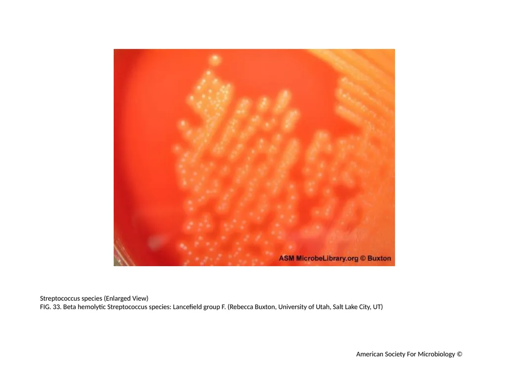 Blood Agar Plates and Hemolysis: Streptococcus - slide 34 of 44