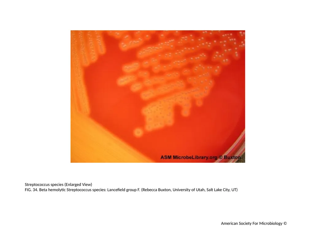 Blood Agar Plates and Hemolysis: Streptococcus - slide 35 of 44