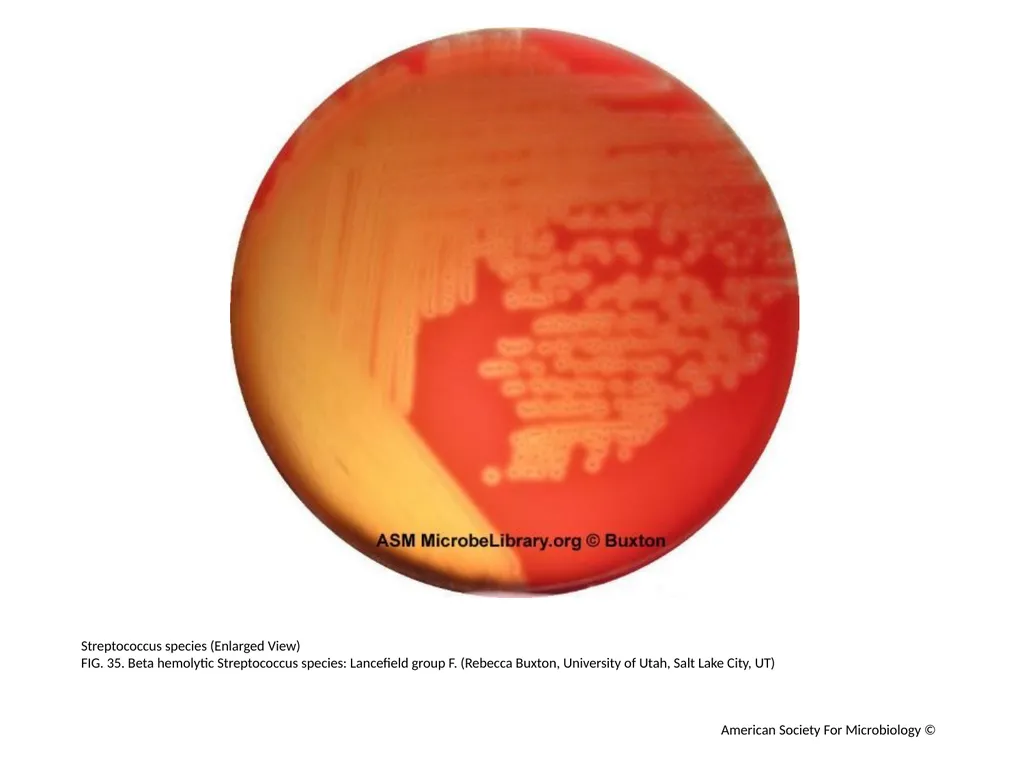 Blood Agar Plates and Hemolysis: Streptococcus - slide 36 of 44