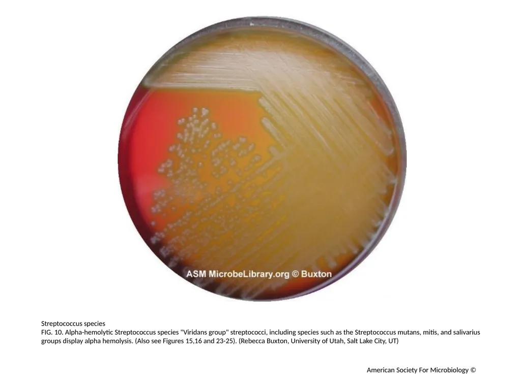 Blood Agar Plates and Hemolysis: Streptococcus - slide 11 of 44