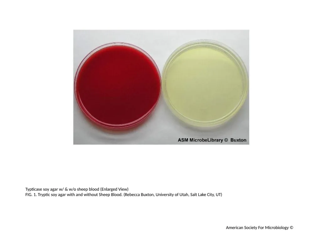 Blood Agar Plates and Hemolysis: Streptococcus - slide 2 of 44