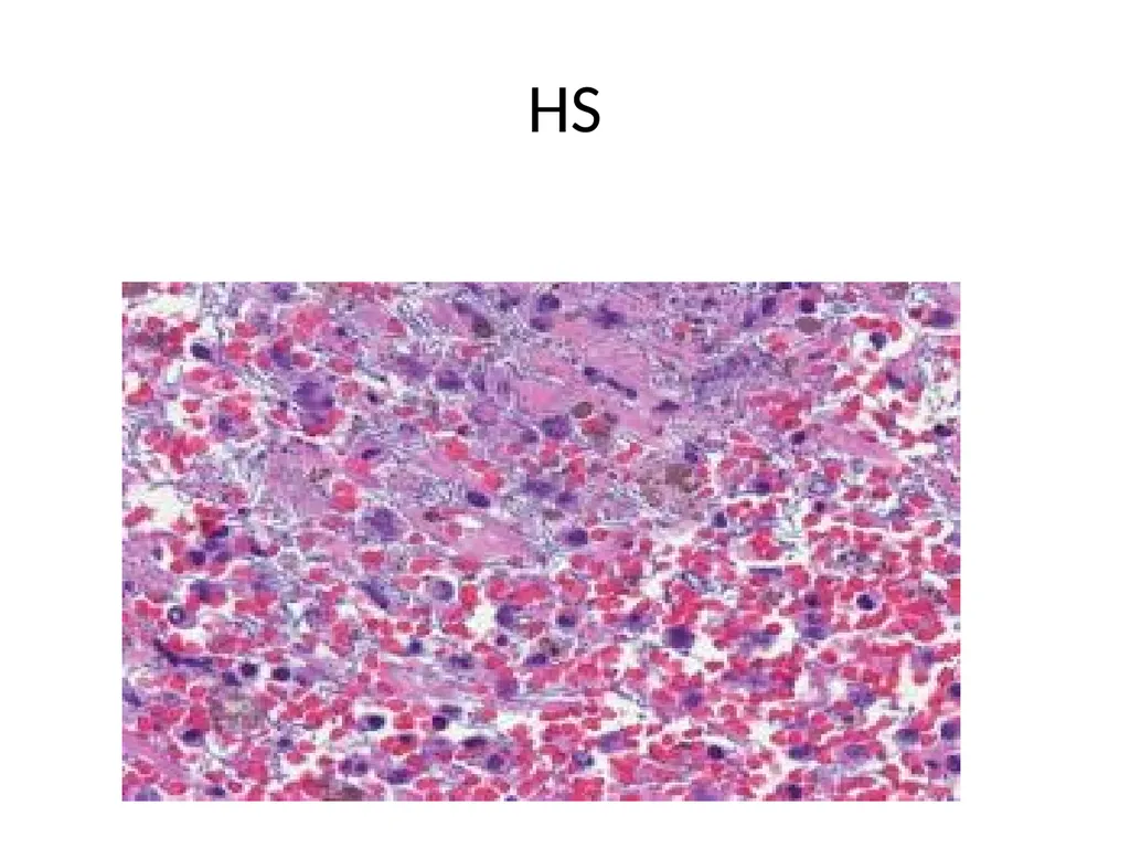 PASTEURELLOSIS Genus – PASTEURELLA MANNHEIMIA P. - slide 19 of 30