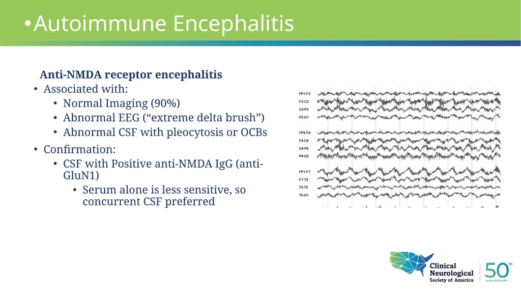 Autoimmune Encephalitis Update William Kilgo, MD - slide 9 of 27