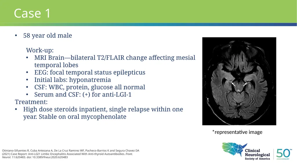 Autoimmune Encephalitis Update William Kilgo, MD - slide 11 of 27
