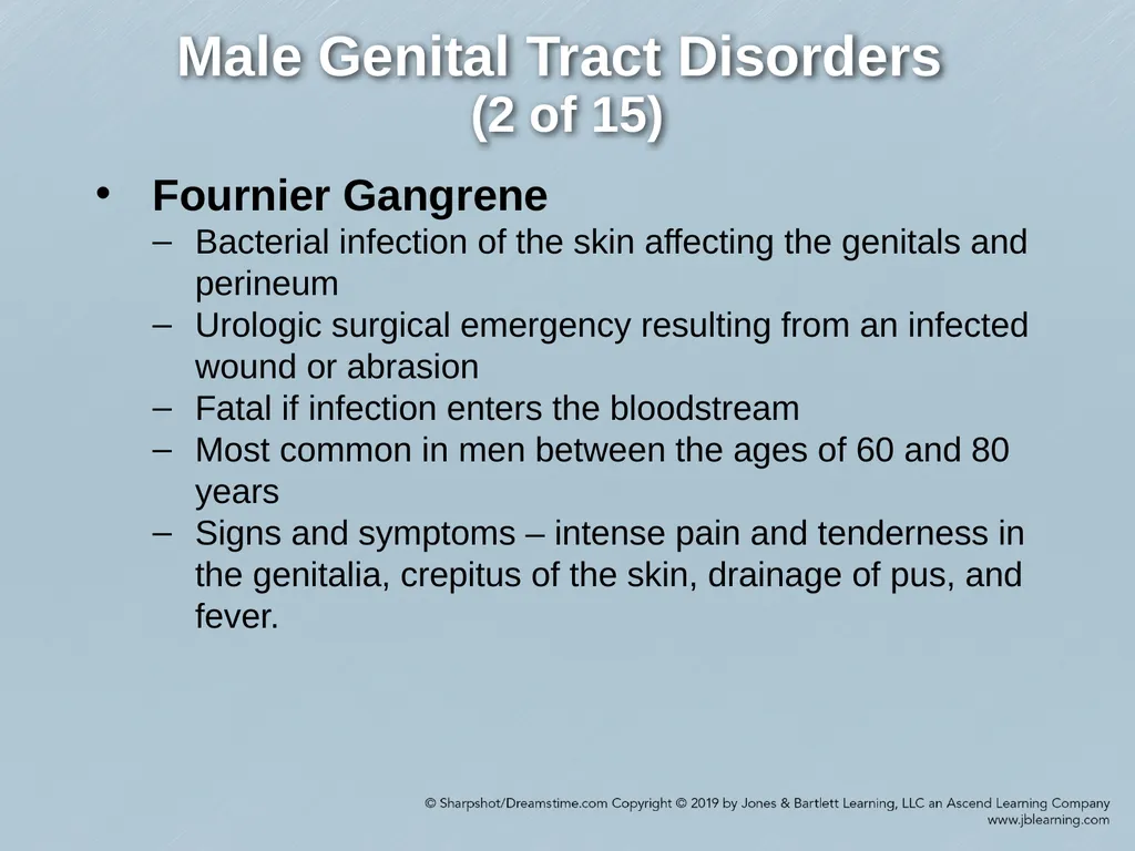 Chapter 29 Genitourinary and Renal Disorders - slide 37 of 52