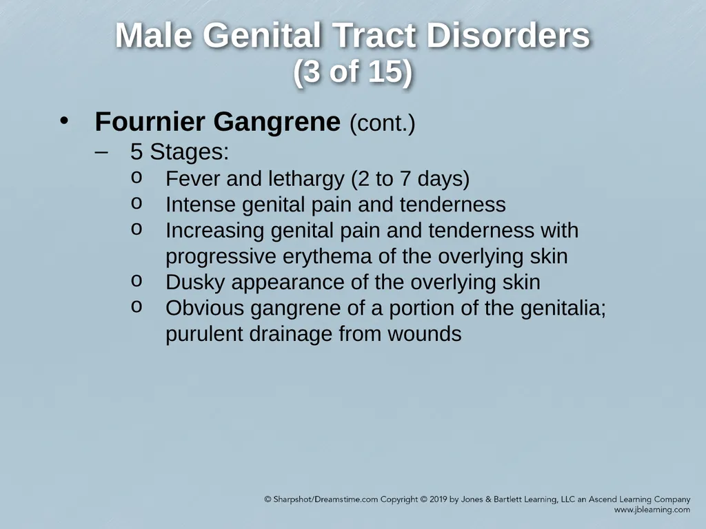 Chapter 29 Genitourinary and Renal Disorders - slide 38 of 52