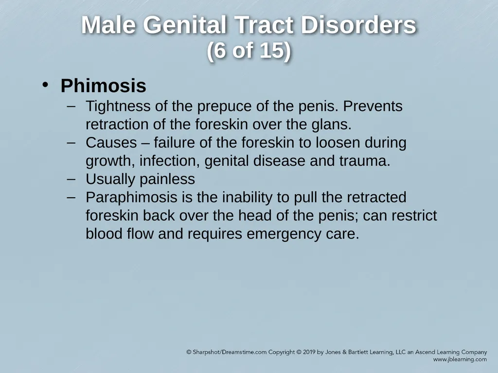 Chapter 29 Genitourinary and Renal Disorders - slide 41 of 52