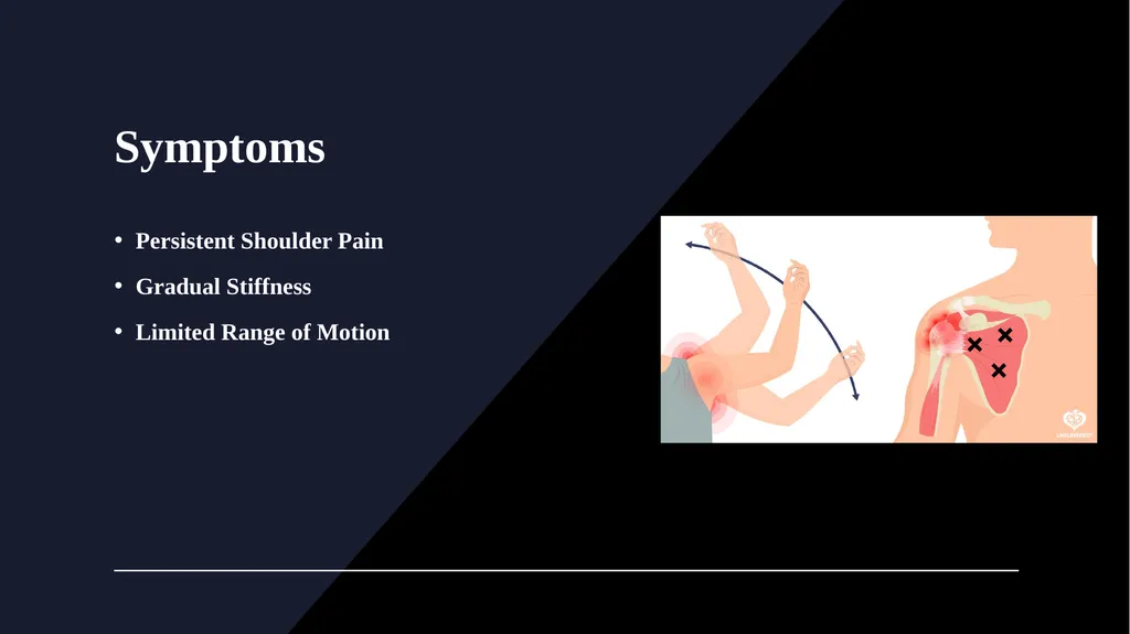Frozen shoulder Faculty of Medicine, Rzeszów - slide 4 of 13
