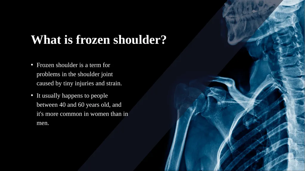 Frozen shoulder Faculty of Medicine, Rzeszów - slide 3 of 13