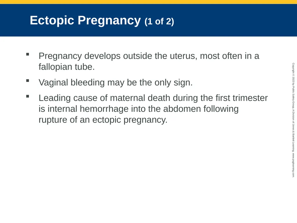 Gynecologic Emergencies CHAPTER 25: Focused - slide 26 of 51