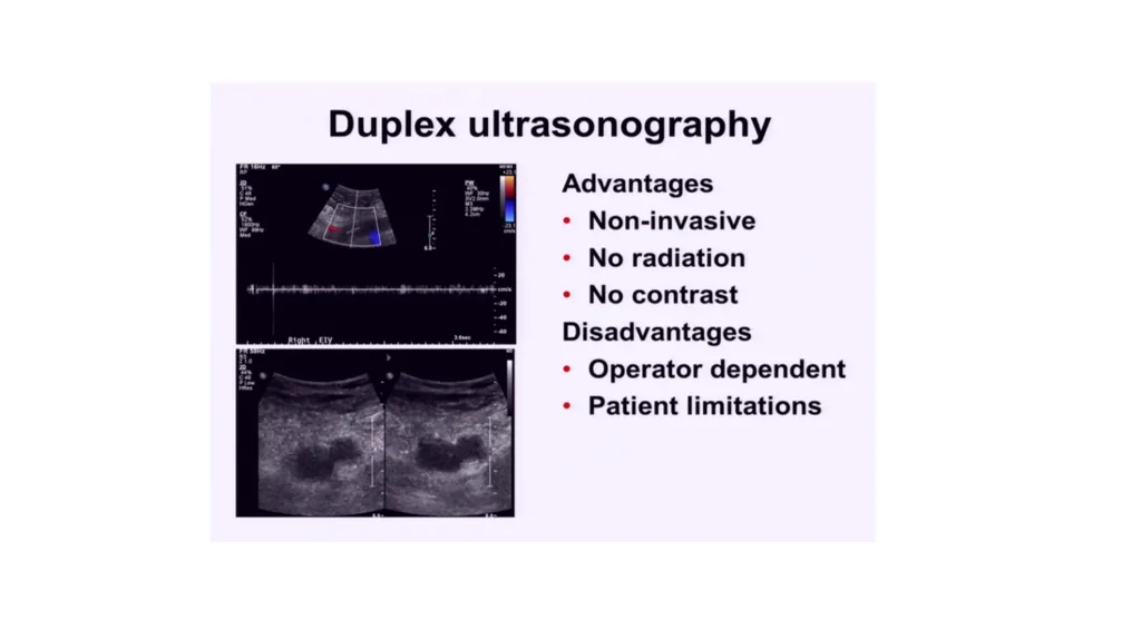 Everything you ever wanted to know about DVT/PE - slide 14 of 42