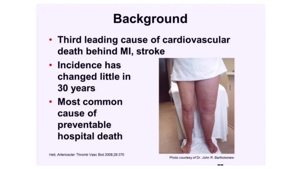 Everything you ever wanted to know about DVT/PE - slide 2 of 42