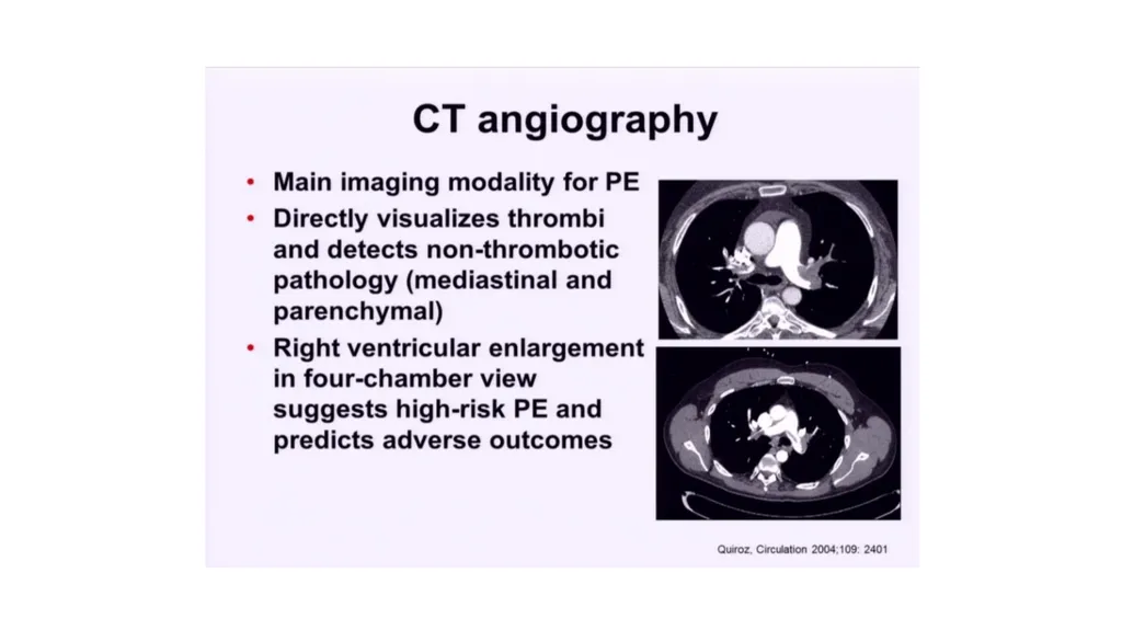 Everything you ever wanted to know about DVT/PE - slide 24 of 42