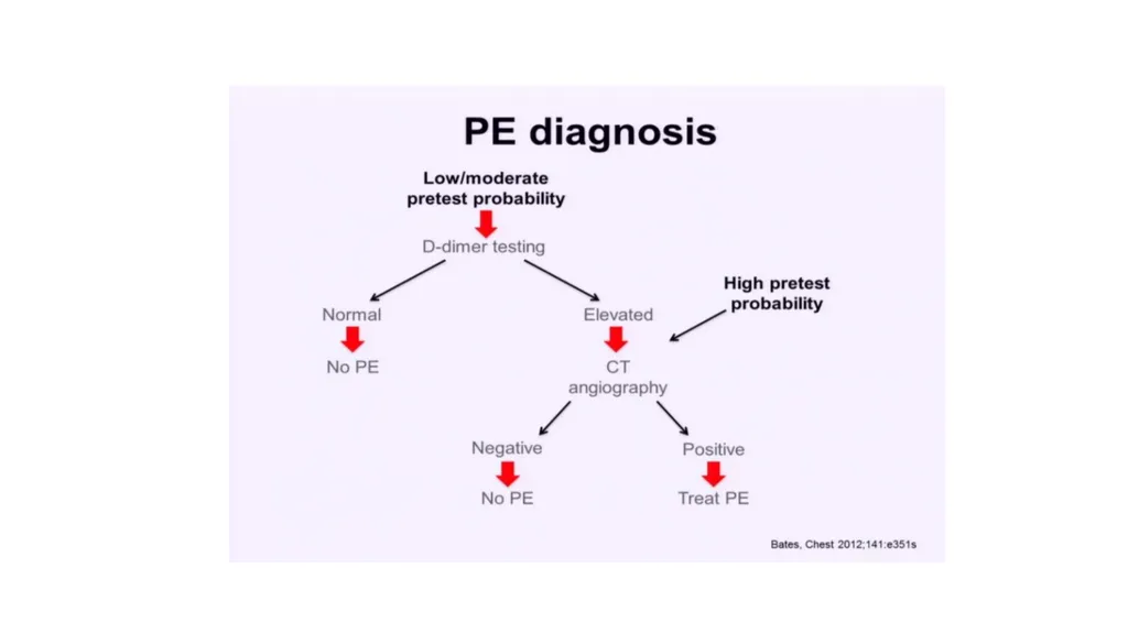 Everything you ever wanted to know about DVT/PE - slide 26 of 42
