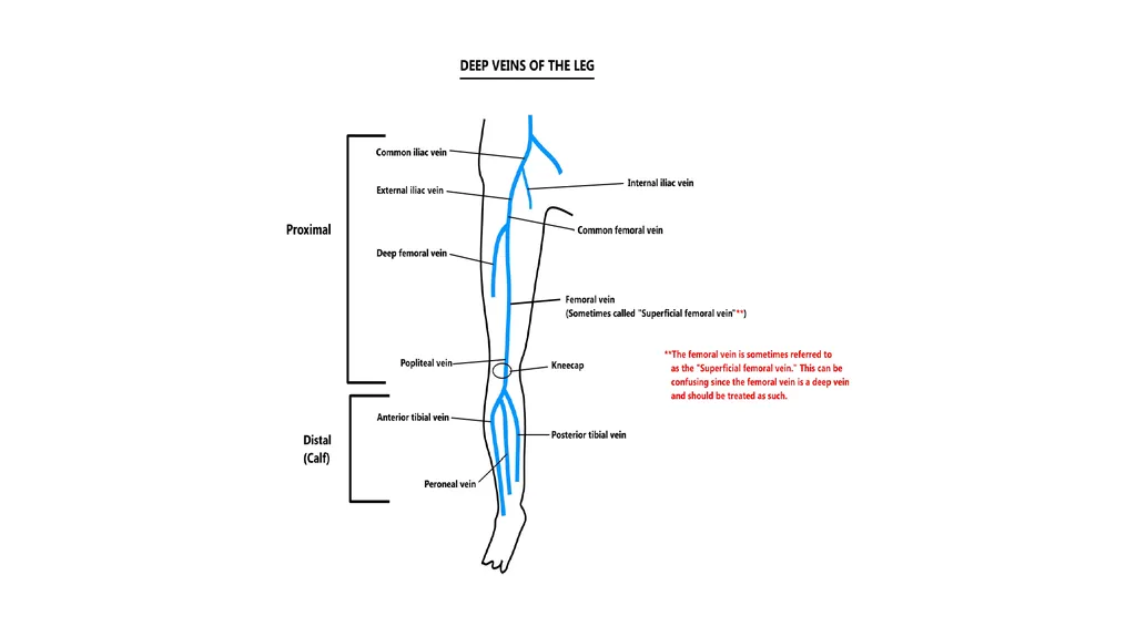 Everything you ever wanted to know about DVT/PE - slide 29 of 42