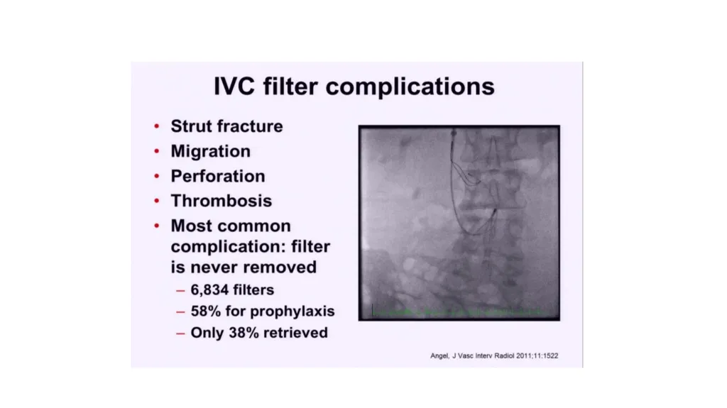 Everything you ever wanted to know about DVT/PE - slide 40 of 42
