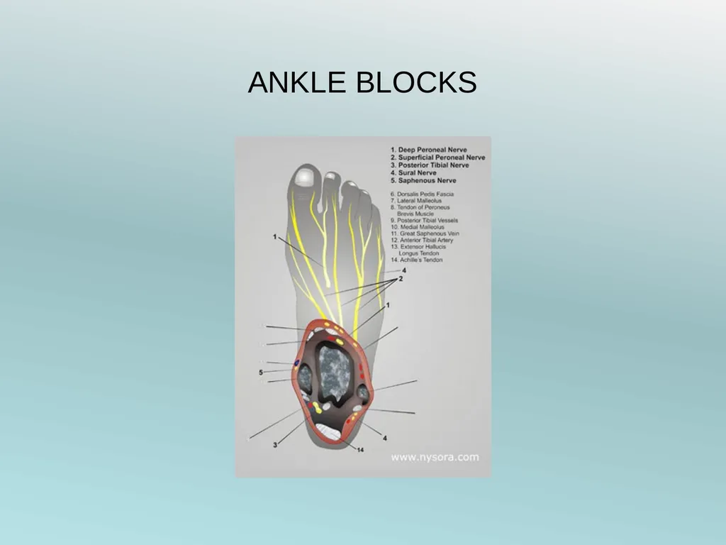 Surgery Under Regional Anesthesia Jean Daniel - slide 60 of 76