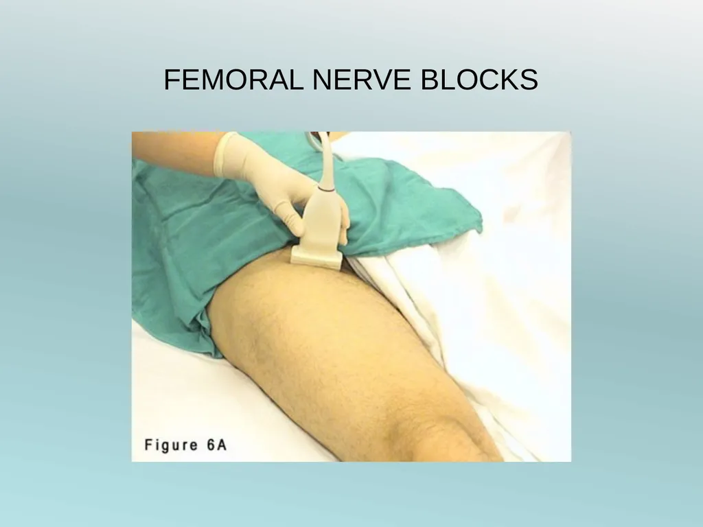 Surgery Under Regional Anesthesia Jean Daniel - slide 44 of 76