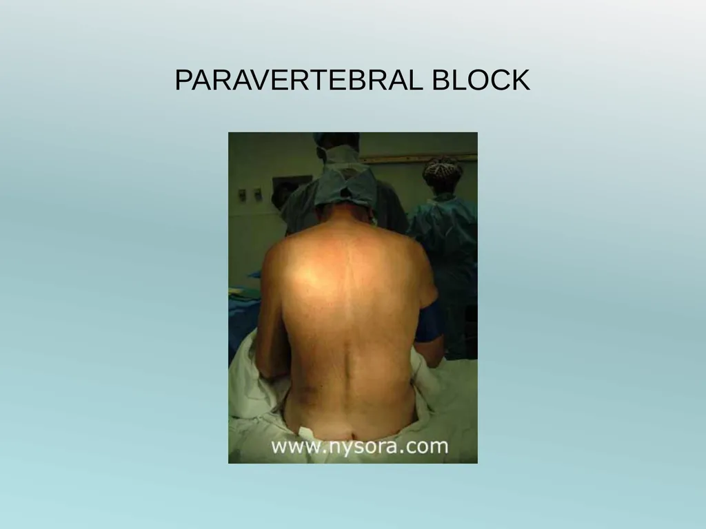 Surgery Under Regional Anesthesia Jean Daniel - slide 71 of 76