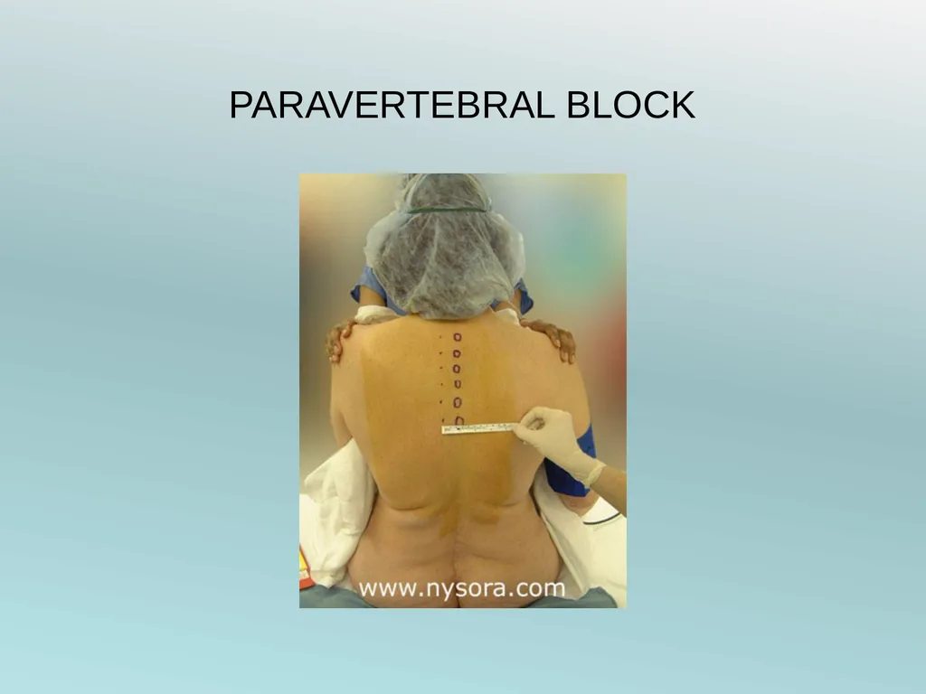 Surgery Under Regional Anesthesia Jean Daniel - slide 72 of 76