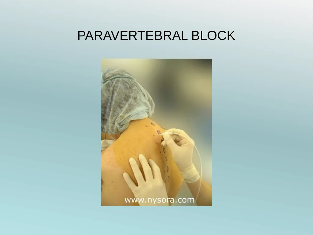 Surgery Under Regional Anesthesia Jean Daniel - slide 74 of 76