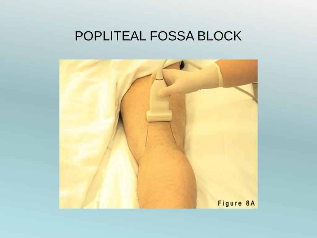 Surgery Under Regional Anesthesia Jean Daniel - slide 56 of 76