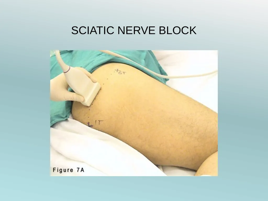 Surgery Under Regional Anesthesia Jean Daniel - slide 47 of 76