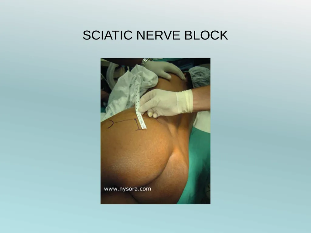 Surgery Under Regional Anesthesia Jean Daniel - slide 51 of 76