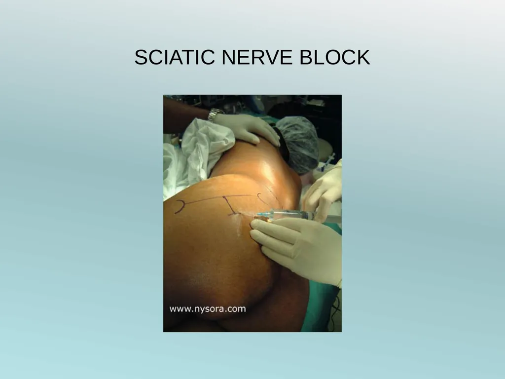 Surgery Under Regional Anesthesia Jean Daniel - slide 52 of 76