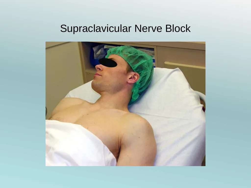 Surgery Under Regional Anesthesia Jean Daniel - slide 18 of 76