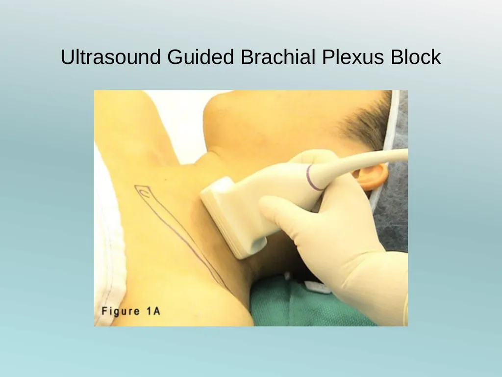 Surgery Under Regional Anesthesia Jean Daniel - slide 9 of 76