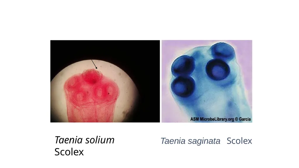 Practical parasitology Platyhelminthes (flat - slide 29 of 31