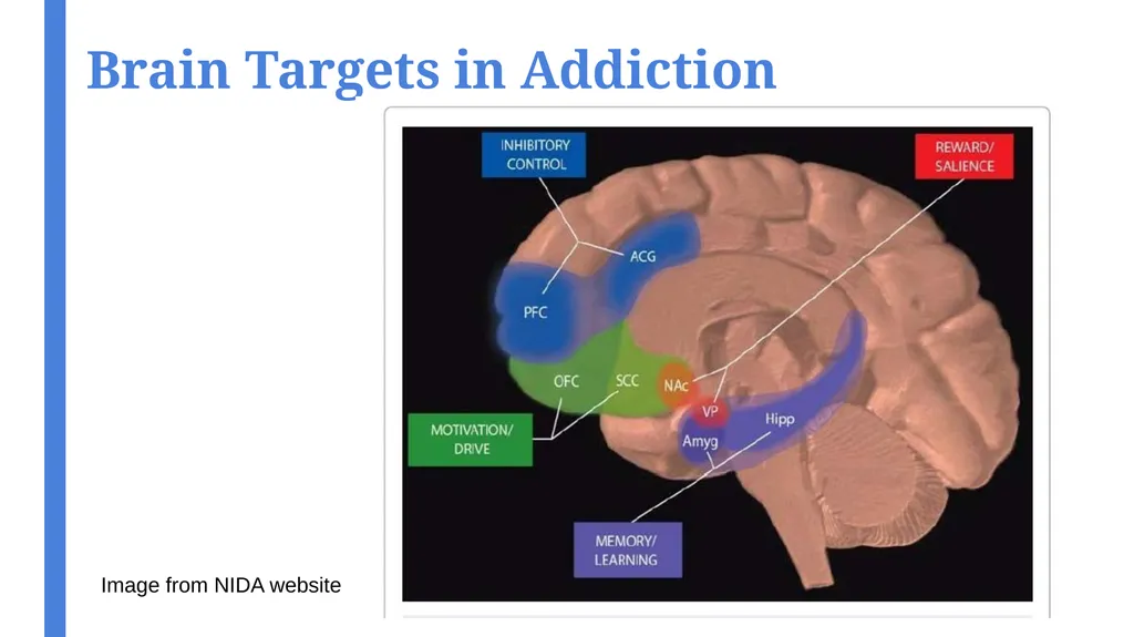An Introduction to Transcranial Magnetic - slide 29 of 48