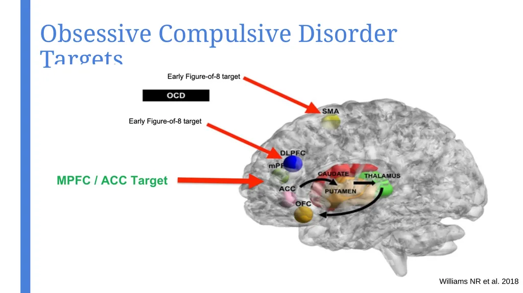 An Introduction to Transcranial Magnetic - slide 24 of 48