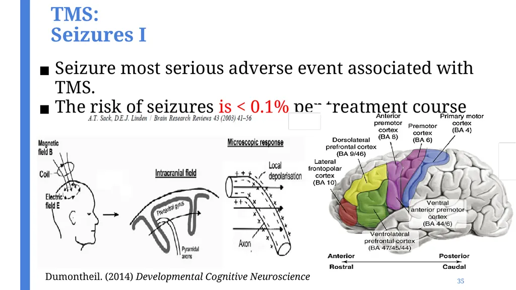 An Introduction to Transcranial Magnetic - slide 35 of 48