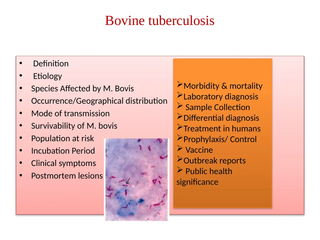 Tuberculosis Dr. Bipin Kumar Assistant Professor - slide 2 of 22