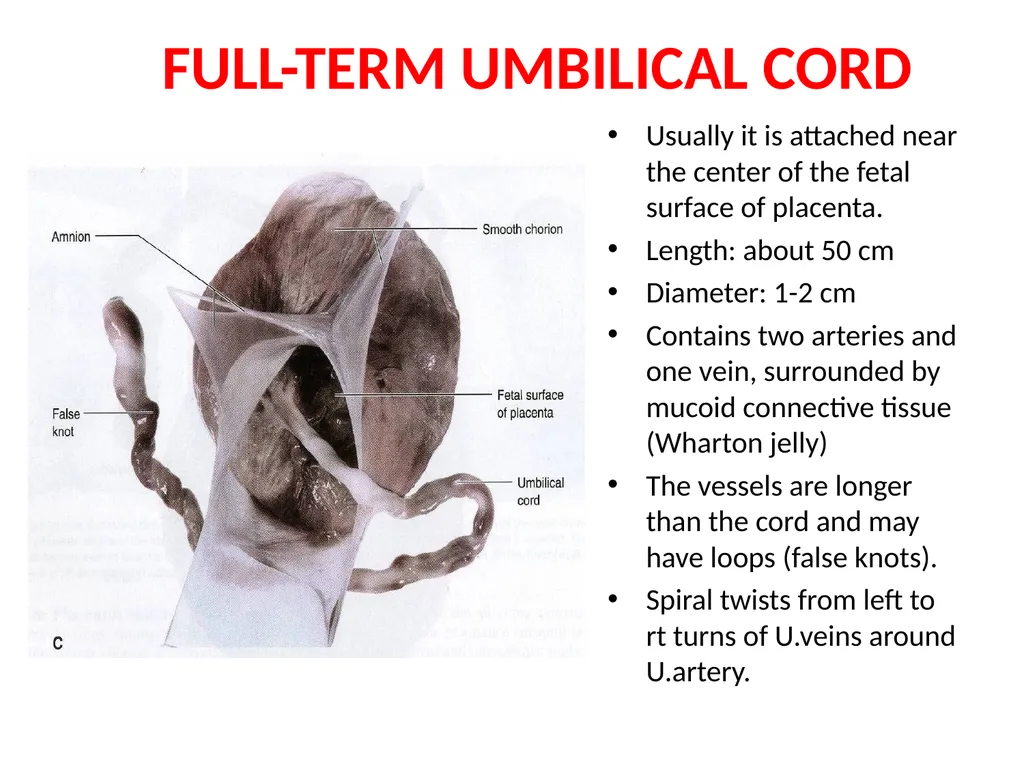 Placenta & Membranes- Development & Anatomy Mrs. - slide 20 of 51