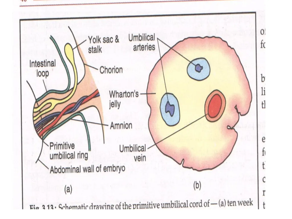 Placenta & Membranes- Development & Anatomy Mrs. - slide 21 of 51