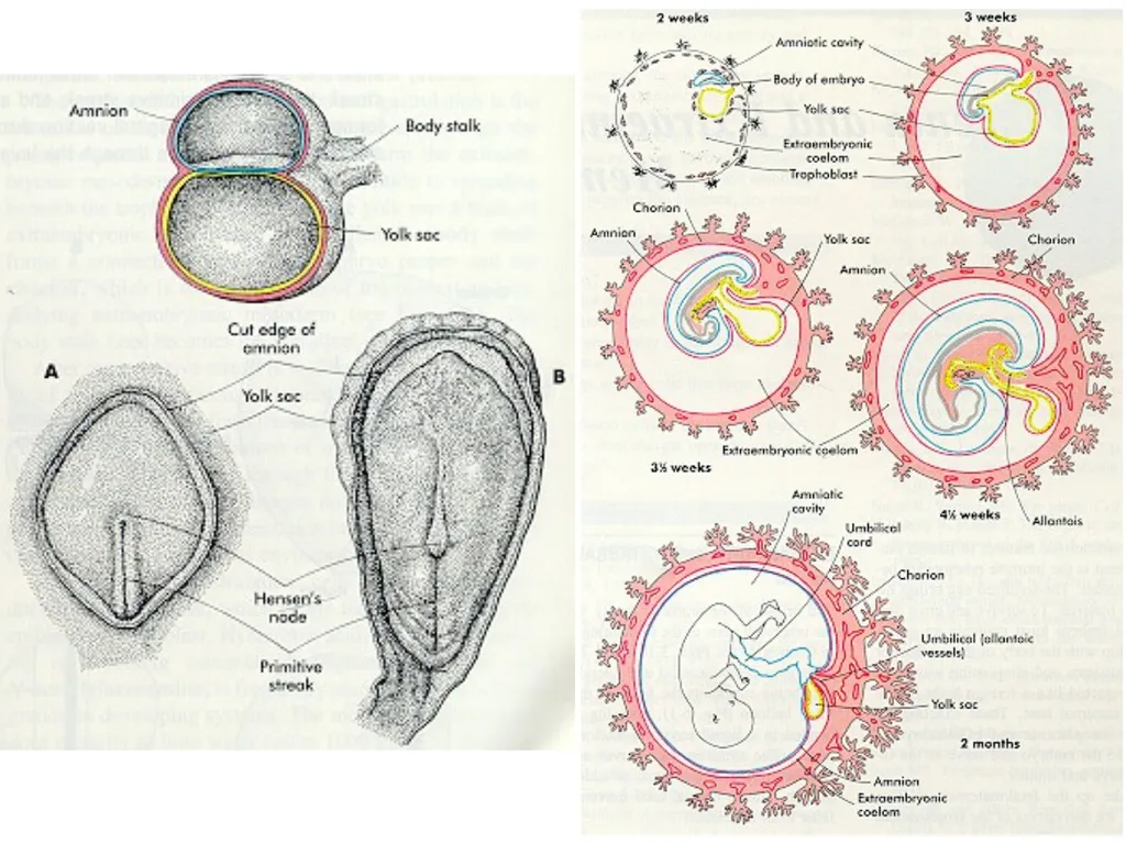 Placenta & Membranes- Development & Anatomy Mrs. - slide 37 of 51