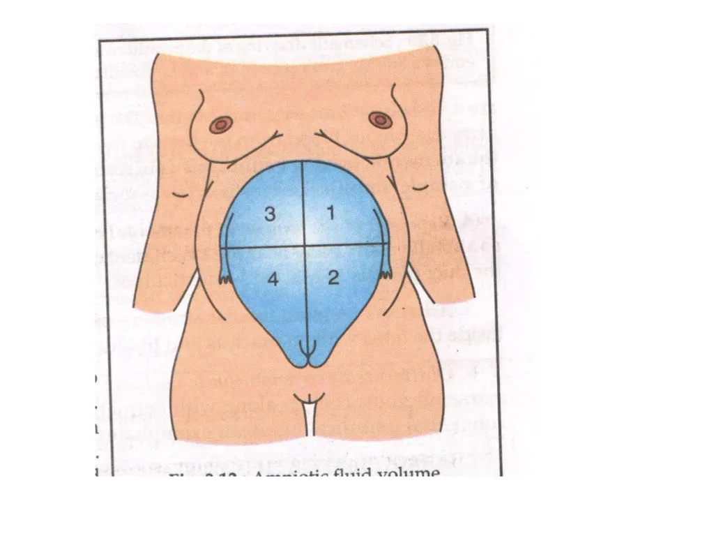 Placenta & Membranes- Development & Anatomy Mrs. - slide 47 of 51