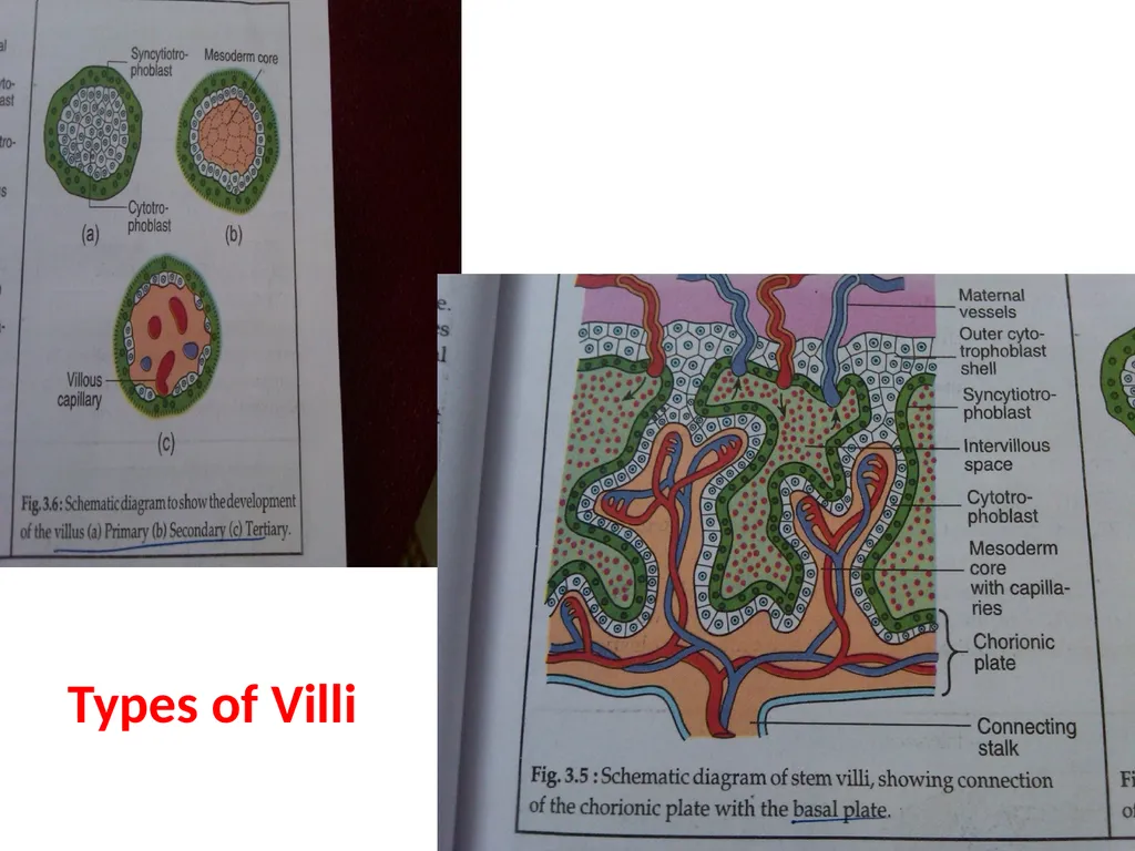 Placenta & Membranes- Development & Anatomy Mrs. - slide 25 of 51