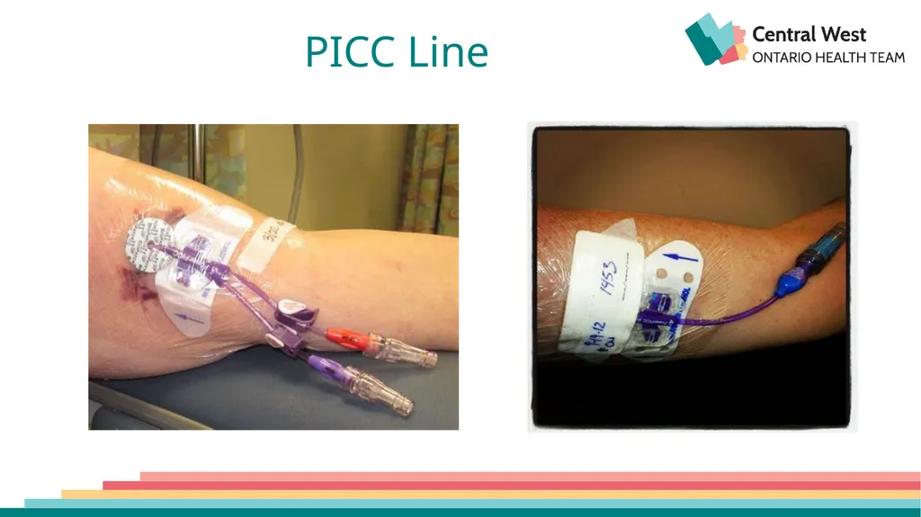Created by: Zankhana Patel, RN, MSN William - slide 6 of 20