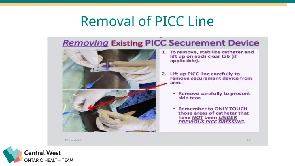 Created by: Zankhana Patel, RN, MSN William - slide 17 of 20