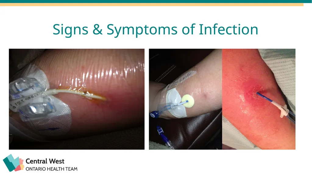 Created by: Zankhana Patel, RN, MSN William - slide 14 of 20