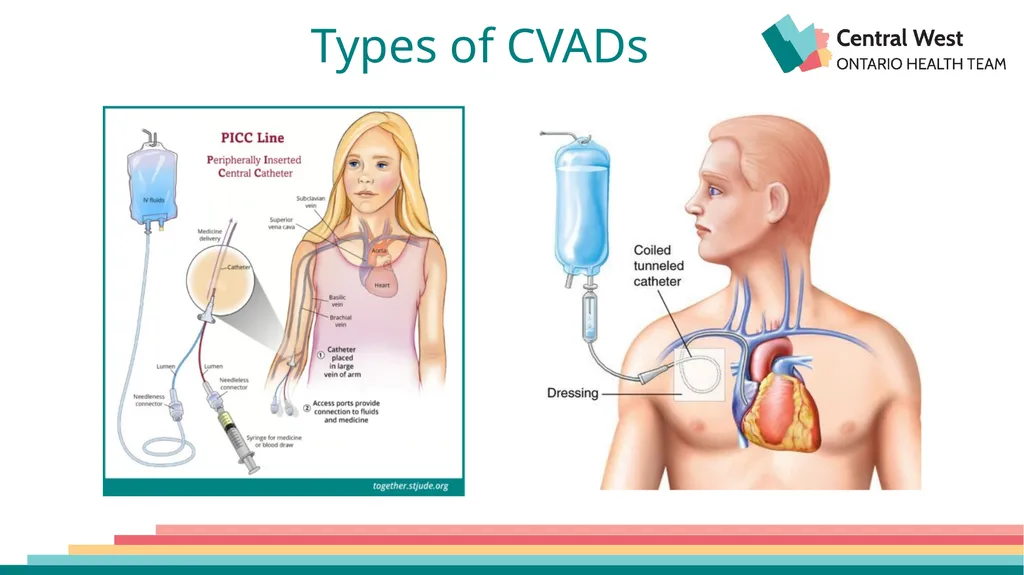 Created by: Zankhana Patel, RN, MSN William - slide 5 of 20