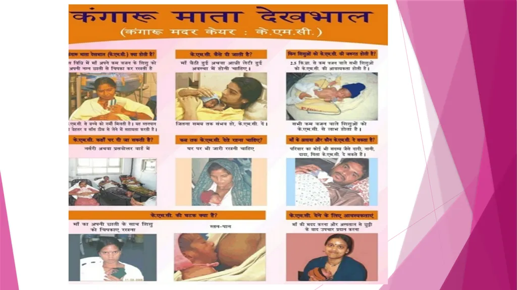 Kangaroo Mother Care Kangaroo mother care : The - slide 2 of 6